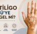 Vitiligo MSÜ’ye Engel Mi?